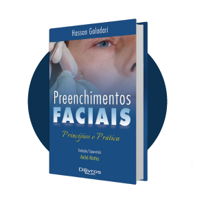 preenchimentos-faciais