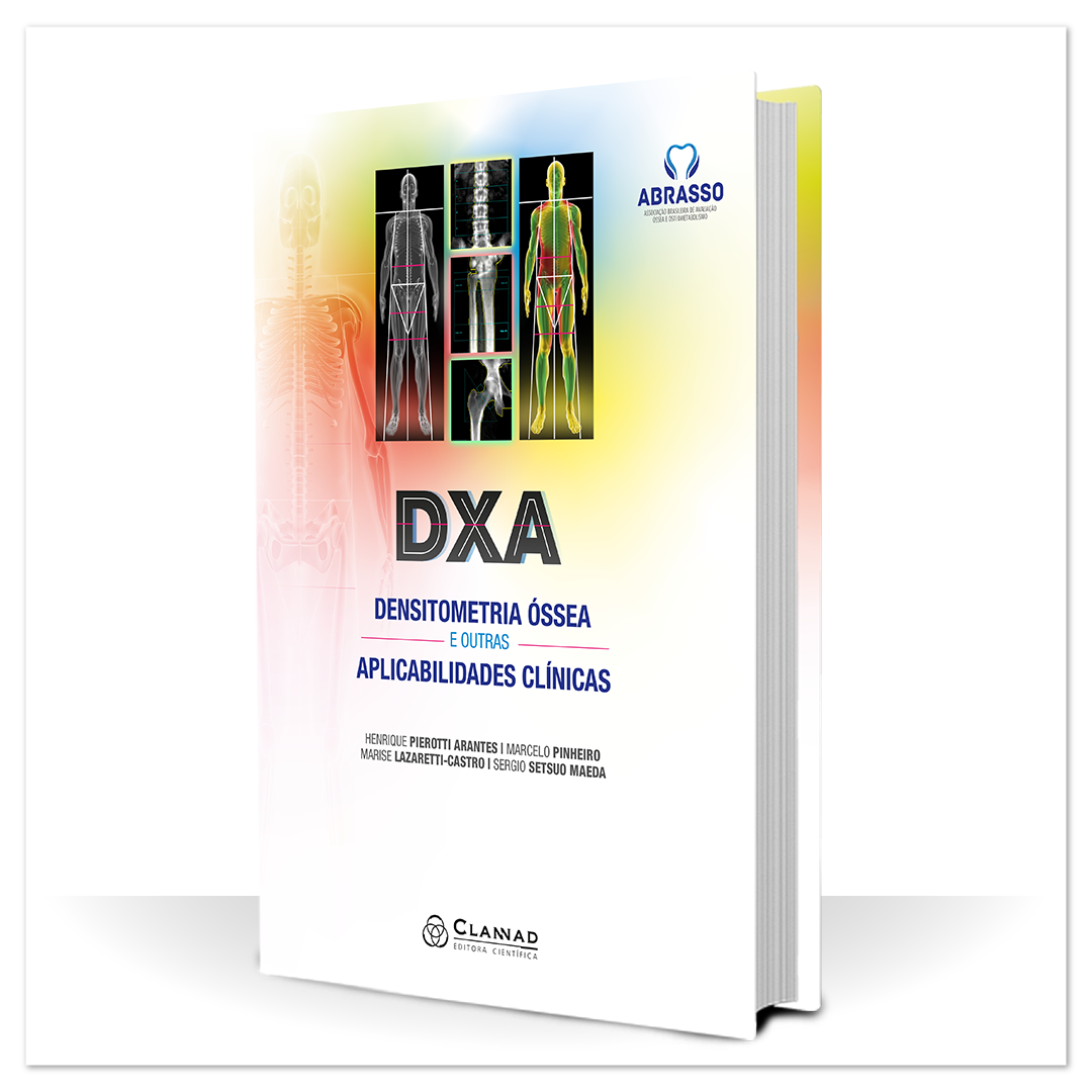 Livros Site Clannad_DXA